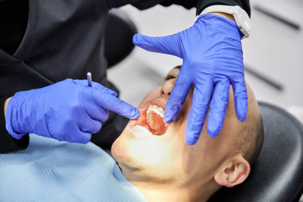 Best Emergency Treatment for Dental Infections or Abscesses in Pemberton Heights, NJ